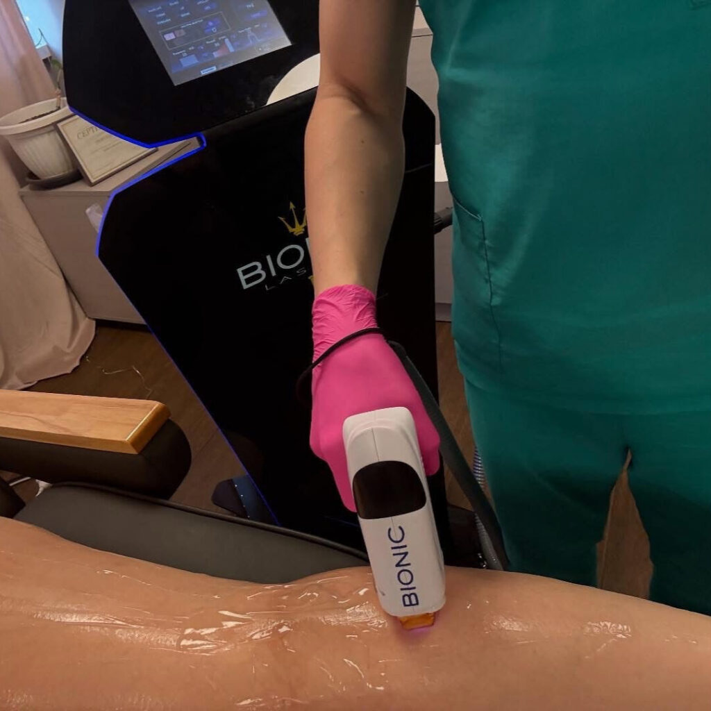 лазерна епилация treya beauty center