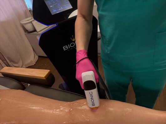 лазер treya beauty center 3